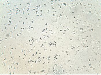 Bild vergößern.  Nosema-Sporen bei 400facher Vergößerung unter dem Lichtmikroskop  (Quelle: D.Thorbahn, JKI)