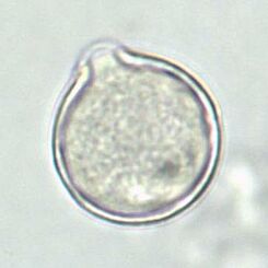 Kartoffelrosen-Pollen (Rosa rugosa); Größe: ca. 30 µm; Quelle: D. Thorbahn, JKI